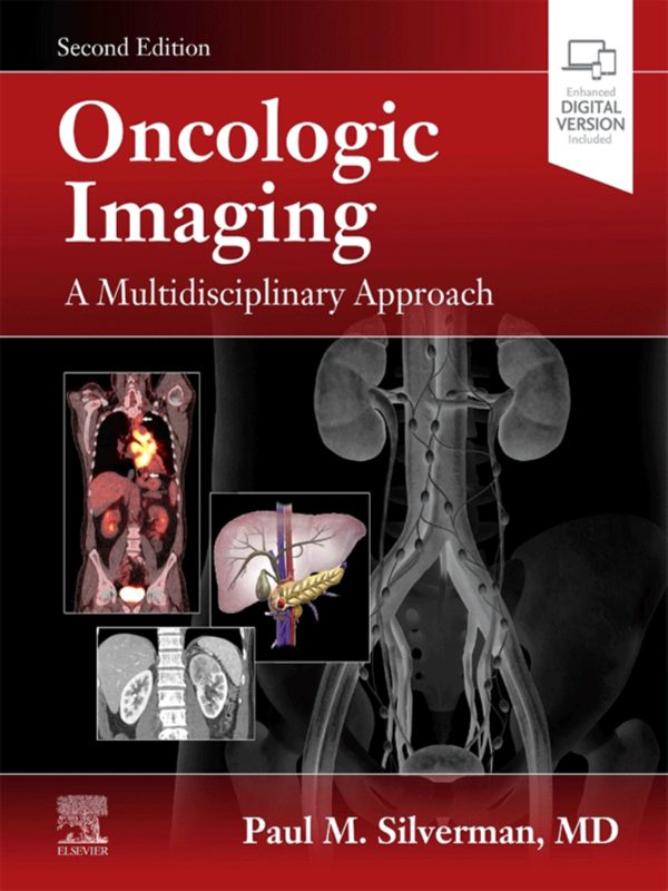 Oncologic Imaging A Multidisciplinary Approach 2e 2nd Edition