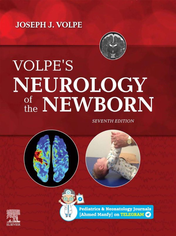 Volpe's Neurology of the Newborn 7e 7th Edition
